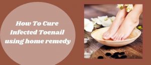 How To Cure Infected Toenail using home remedy