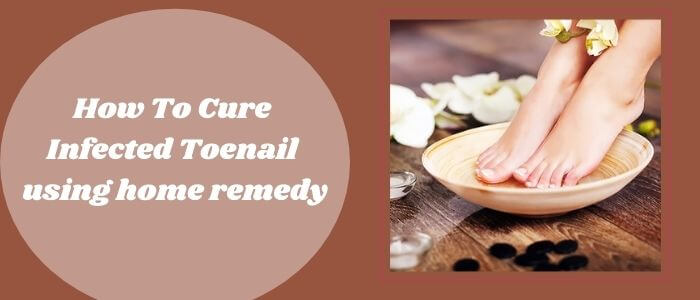 How To Cure Infected Toenail using home remedy