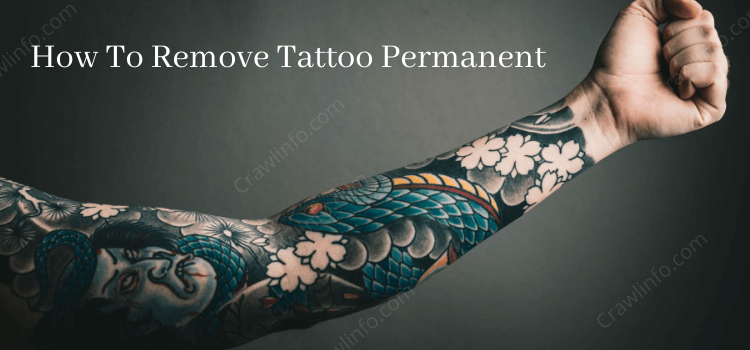 Full tattoo removal ny