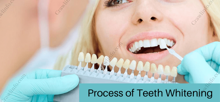 Process of Teeth Whitening