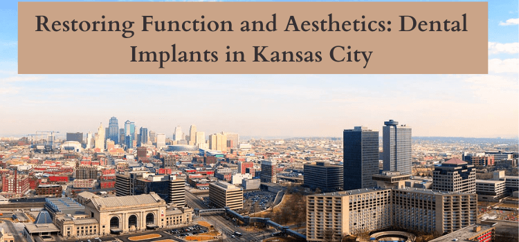 Dental Implants in Kansas City